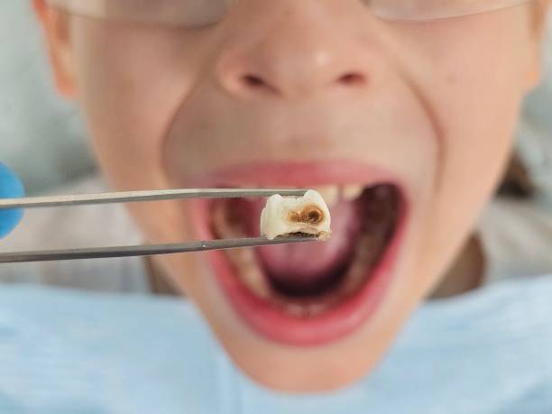 Best Pediatric Emergency Dentist in Pierre, SD